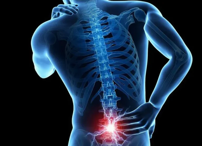 espondilosis lumbar incapacidad laboral